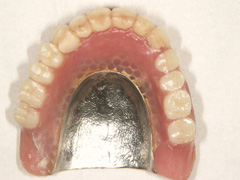 粘膜調整義歯の写真