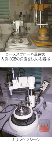 コーヌスクローネ義歯とは?